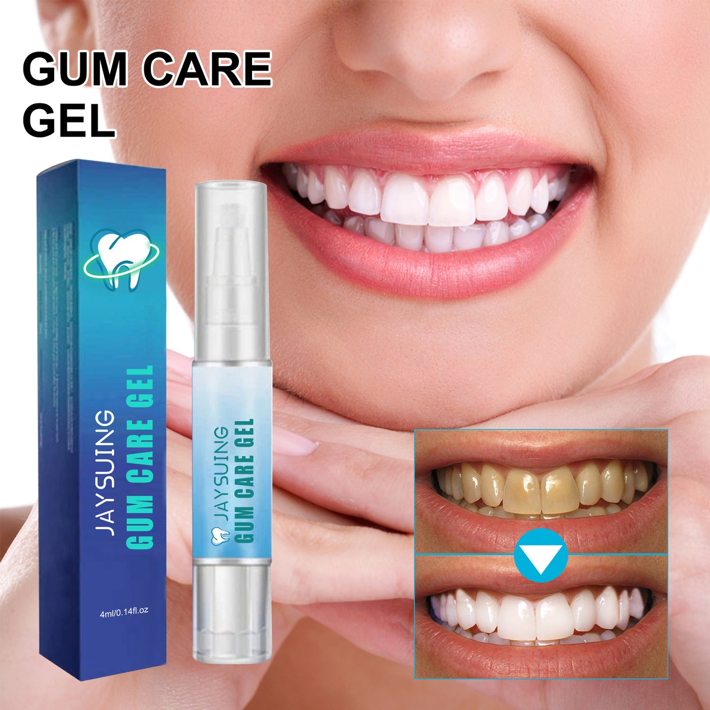 Teeth Whitening Gel